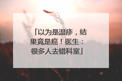 以为是湿疹，结果竟是癌！医生：很多人去错科室